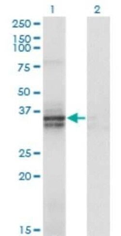 ST3 beta-Gal alpha-2,3-Sialyltransferase 2/ST3GAL2 Antibody (1E12), Novus Biologicals 0.1 mg | Buy Online | Novus Biologicals | Fisher Scientific