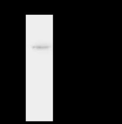 ST3 beta-Gal alpha-2,3-Sialyltransferase 2/ST3GAL2 Antibody, Novus Biologicals:Antibodies:Primary
