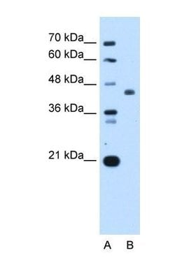 ST3GAL4 Antibody, Novus Biologicals ST3GAL4 Antibody; Unconjugated; 100