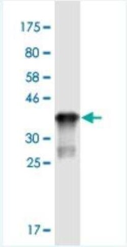 ST3GAL5 Antibody (8B4), Novus Biologicals 100 &mu;g | Buy Online | Novus Biologicals | Fisher Scientific