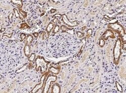 ST6 Gal Sialyltransferase 1/ST6GAL1/CD75 Rabbit anti-Human, Clone: 36,