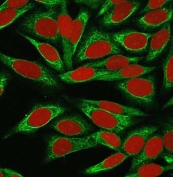 ST6 Gal Sialyltransferase 1/ST6GAL1/CD75 Antibody (LN-1), Novus Biologicals:Antibodies:Primary