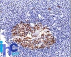 ST6 Gal Sialyltransferase 1/ST6GAL1/CD75 Antibody (LN-1), Novus Biologicals:Antibodies:Primary