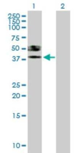 ST6 Sialyltransferase 6/ST6GALNAC6 Antibody, Novus Biologicals 0.05 mg | Buy Online | Novus Biologicals | Fisher Scientific