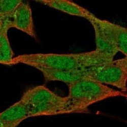 ST8 alpha-2,8-Sialyltransferase 8B/ST8SIA2 Rabbit anti-Human, Polyclonal,