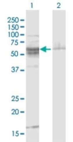 ST8 alpha-2,8-Sialyltransferase 8B/ST8SIA2 Antibody, Novus Biologicals 0.1 mg | Buy Online | Novus Biologicals | Fisher Scientific