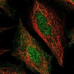 STAMP2/STEAP4 Rabbit anti-Human, Polyclonal, Novus Biologicals 100 &mu;g;