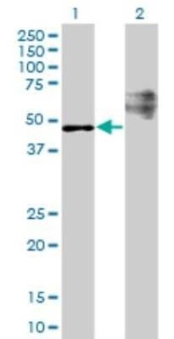 STARD3 Antibody (1D1), Novus Biologicals 0.1 mg | Buy Online | Novus Biologicals | Fisher Scientific
