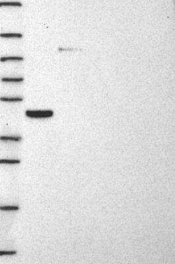 STARD3 Rabbit anti-Human, Polyclonal, Novus Biologicals:Antibodies:Primary