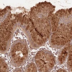 START domain containing 7 Antibody, Novus Biologicals 25 &mu;L, Unconjugated:Antibodies,
