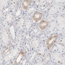 STAT1 Antibody, Novus Biologicals 25 &mu;L | Buy Online | Novus Biologicals | Fisher Scientific
