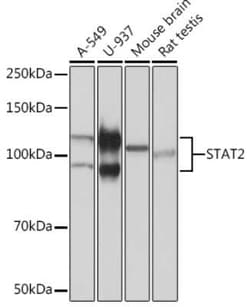 STAT2 Rabbit anti-Human, Mouse, Rat, Clone: 5Y3W4, Novus Biologicals 20 &mu;g | Buy Online | Novus Biologicals | Fisher Scientific