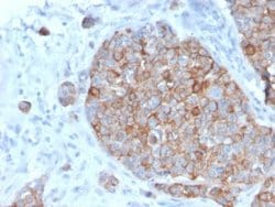 STAT2 Antibody (STAT2/2650) - Azide and BSA Free, Novus Biologicals 100