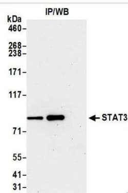 STAT3 Antibody (BLR098G), Novus Biologicals 100 &mu;g | Buy Online | Novus Biologicals | Fisher Scientific