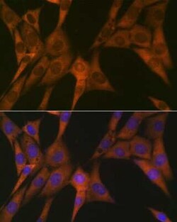 STAT4 Rabbit anti-Human, Mouse, Rat, Clone: 10H10O9, Novus Biologicals 20 &mu;g | Buy Online | Novus Biologicals | Fisher Scientific