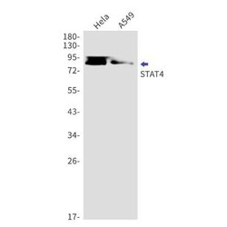 STAT4 Rabbit anti-Human, Clone: S02-1C1, Novus Biologicals 100 &mu;g | Buy Online | Novus Biologicals | Fisher Scientific