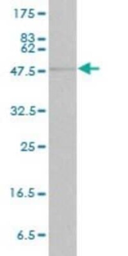 STAT4 Antibody (1C2-1C12), Novus Biologicals 0.1 mg | Buy Online | Novus Biologicals | Fisher Scientific
