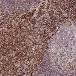 STAT5A Antibody, Novus Biologicals 0.1 mL, Unconjugated:Antibodies, Polyclonal