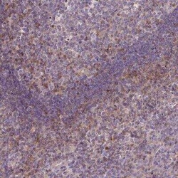 STAT5A Antibody, Novus Biologicals:Antibodies:Primary Antibodies