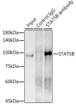 STAT5b Rabbit anti-Human, Mouse, Rat, Clone: 6P5T0, Novus Biologicals:Antibodies:Primary