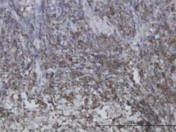 STAT5b Antibody (2D1), Novus Biologicals 0.1 mg | Buy Online | Novus Biologicals | Fisher Scientific