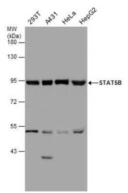 STAT5b Antibody, Novus Biologicals 100 &mu;g | Buy Online | Novus Biologicals | Fisher Scientific