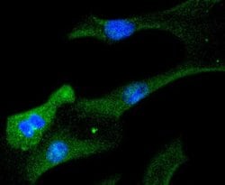 STAT6 Rabbit anti-Human, Clone: SY13-09, Novus Biologicals 100&mu;L:Antibodies,