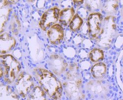 STAT6 Rabbit anti-Human, Clone: SY13-09, Novus Biologicals 100&mu;L:Antibodies,