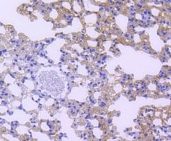 STAT6 Rabbit anti-Human, Clone: SY13-09, Novus Biologicals 100&mu;L:Antibodies,