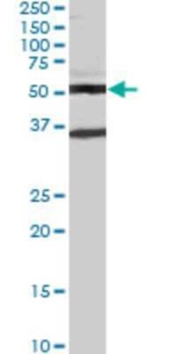 STAU2 Antibody (1B9), Novus Biologicals 0.1 mg | Buy Online | Novus Biologicals | Fisher Scientific
