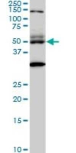STAU2 Antibody (5C5), Novus Biologicals 0.1 mg | Buy Online | Novus Biologicals | Fisher Scientific