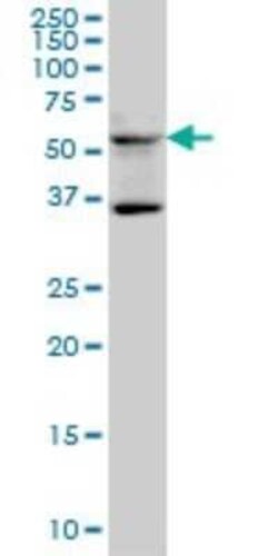 STAU2 Antibody (5C5), Novus Biologicals 0.1 mg | Buy Online | Novus Biologicals | Fisher Scientific