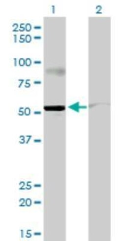 STAU2 Antibody (5C5), Novus Biologicals 0.1 mg | Buy Online | Novus Biologicals | Fisher Scientific