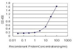 STEAP1 Antibody (4F6-1F3), Novus Biologicals 0.05 mg | Buy Online | Novus Biologicals | Fisher Scientific