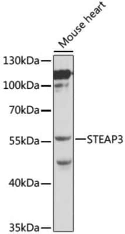 STEAP3/TSAP6 Antibody - BSA Free, Novus Biologicals 0.02 mL; Unconjugated:Antibodies,