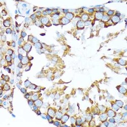 STI1 Rabbit anti-Human, Mouse, Rat, Clone: 4S8L6, Novus Biologicals:Antibodies:Primary