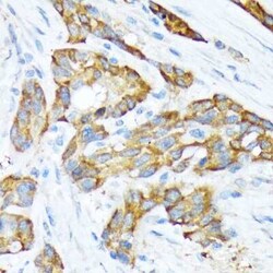 STI1 Rabbit anti-Human, Mouse, Rat, Clone: 4S8L6, Novus Biologicals:Antibodies:Primary