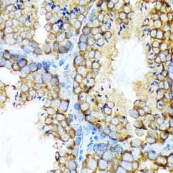 STI1 Rabbit anti-Human, Mouse, Rat, Clone: 4S8L6, Novus Biologicals:Antibodies:Primary