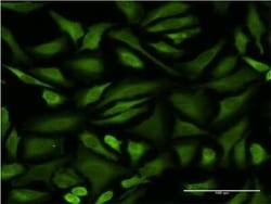 STI1 Antibody (1C6), Novus Biologicals 0.1 mg | Buy Online | Novus Biologicals | Fisher Scientific