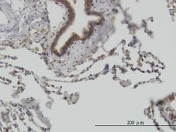 STI1 Antibody (1E3), Novus Biologicals 0.1 mg | Buy Online | Novus Biologicals | Fisher Scientific