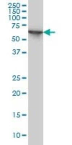 STI1 Antibody (1E3), Novus Biologicals 0.1 mg | Buy Online | Novus Biologicals | Fisher Scientific