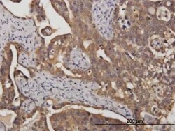 STI1 Antibody (2E11), Novus Biologicals 0.1 mg | Buy Online | Novus Biologicals | Fisher Scientific