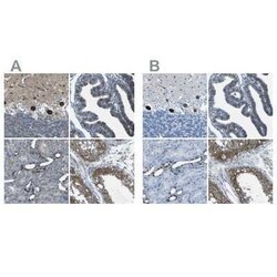 STIM1 Antibody, Novus Biologicals:Anticuerpos:Anticuerpos primarios