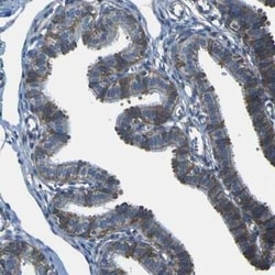 STIM1 Antibody, Novus Biologicals:Anticuerpos:Anticuerpos primarios