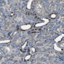 STIM1 Antibody, Novus Biologicals:Anticuerpos:Anticuerpos primarios
