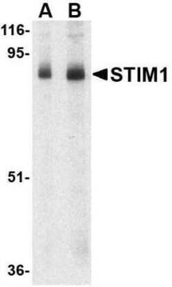 STIM1 Antibody - BSA Free, Novus Biologicals 0.1 mg | Buy Online | Novus Biologicals | Fisher Scientific