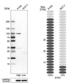 STIM1 Antibody, Novus Biologicals:Anticuerpos:Anticuerpos primarios