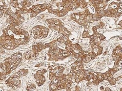 STK16 Antibody, Novus Biologicals:Antibodies:Primary Antibodies