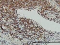 STK16 Antibody (M2), Novus Biologicals 0.1 mg | Buy Online | Novus Biologicals | Fisher Scientific