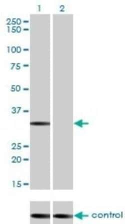 STK16 Antibody (M2), Novus Biologicals 0.1 mg | Buy Online | Novus Biologicals | Fisher Scientific